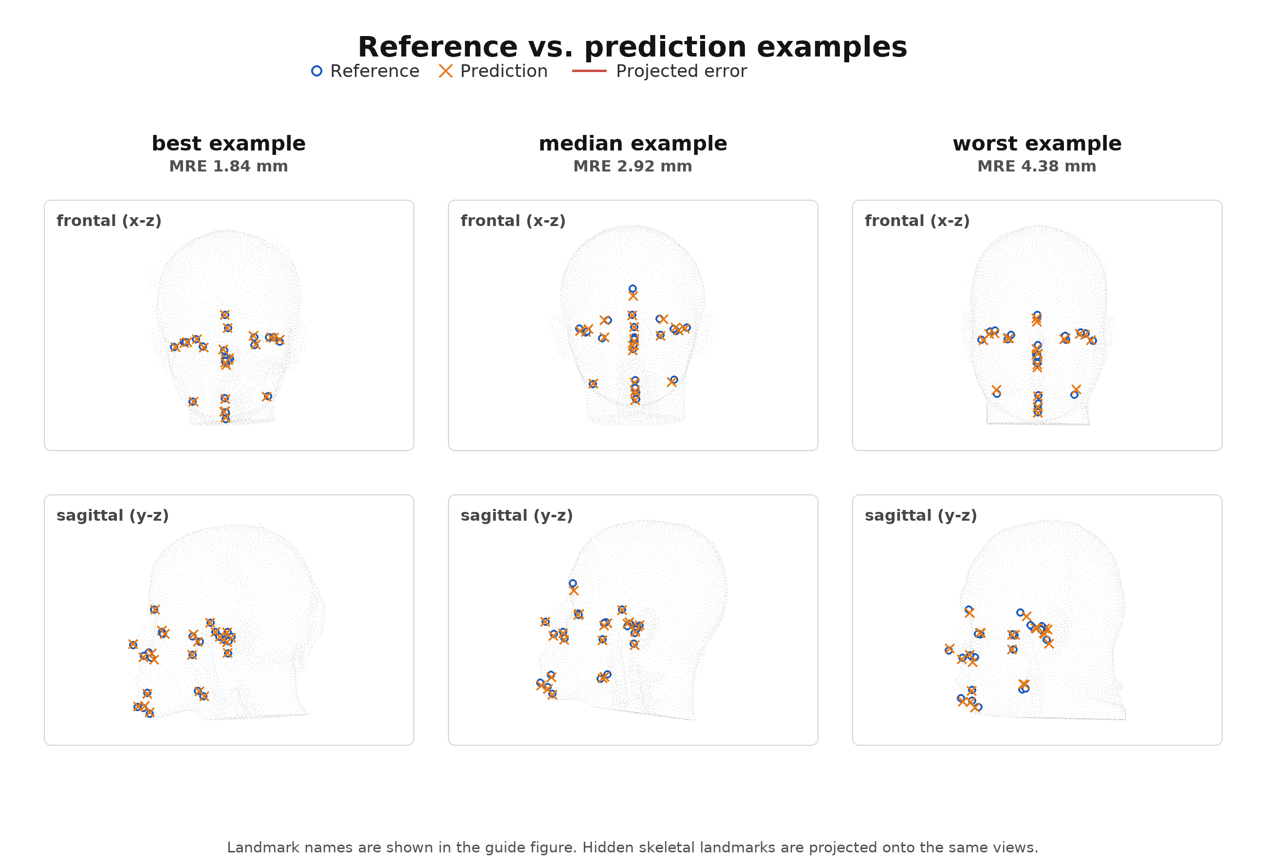 Best, median, and worst test cases showing reference and predicted landmarks projected onto frontal and sagittal views.